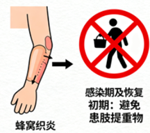 [图片占位：避免患肢提重物]