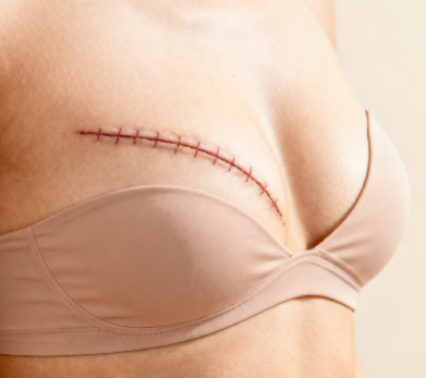 [图片占位：血压稳定性]